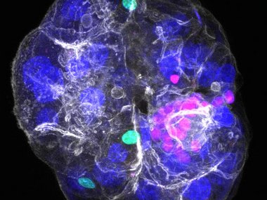 Periportal liver assembloid model