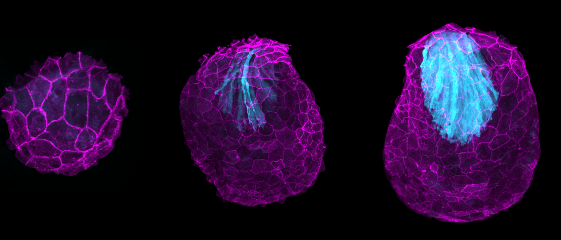 A growing pectoral fin of transgenic zebrafish at different stages of development. The transgenic is a responsive reporter line of the YAP mechanosensitive pathway. YAP becomes increasingly active in the muscle over developmental time (depicted in cyan). The constituent cell membranes are labelled in magenta.
This zebrafish pectoral fin was imaged by Shivani Gunnan, IMPRS Predoc since 2024 from the Rita Mateus Lab.