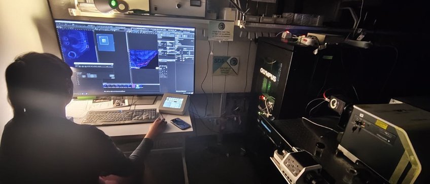 One of our scientists imaging her samples at a spining-disk confocal microscope One of our scientists imaging her samples at a spining-disk confocal microscope