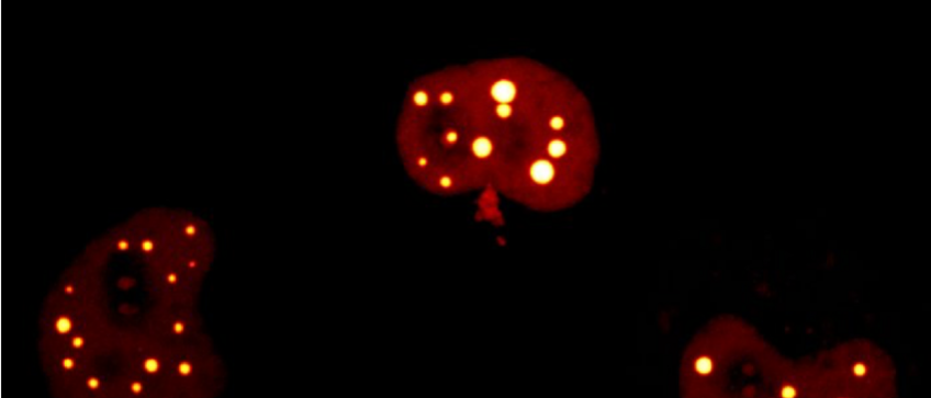 Molecular condensates inside cell Molecular condensates inside cell