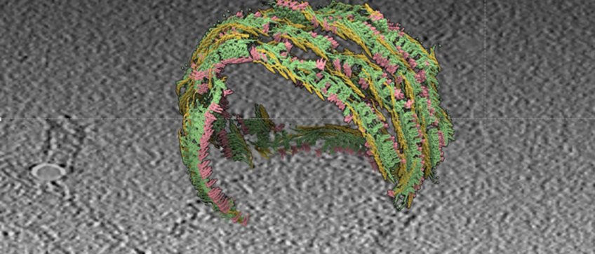 Cryo-EM structure of a purified nuclear envelope protein, imaged by Mareike Jordan, postdoc in the Alexander von Appen lab Cryo-EM structure of a purified nuclear envelope protein, imaged by Mareike Jordan, postdoc in the Alexander von Appen lab