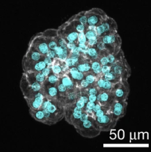 Human assembloids recapitulate periportal liver tissue in vitro