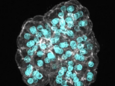 Human assembloids recapitulate periportal liver tissue in vitro